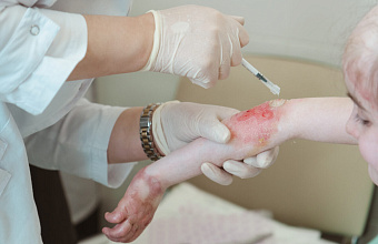 'Butterfly children' to be treated with innovative drug in Dagestan